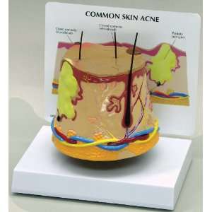 Skin Acne Anatomical Model  Industrial & Scientific