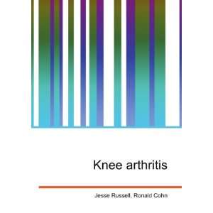 Knee arthritis [Paperback]