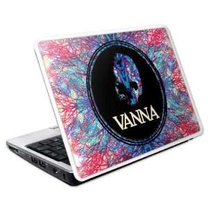   Netbook Large  9.8 x 6.7  Vanna  A New Hope Skin Electronics