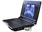 cms600p3 smart notebook lapto p ultrasound scanner b ultr asound